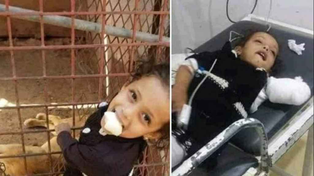 في هذا البلد العربي.. أسد يلتهم يد طفلة