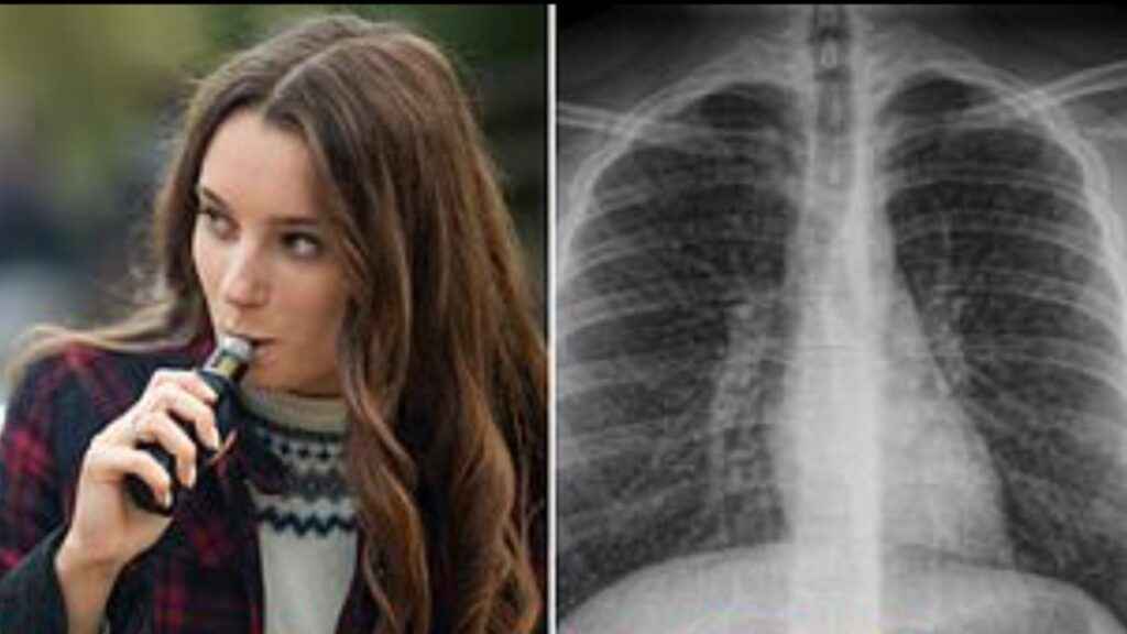 تحذير مرعب من السجائر الإلكترونية للشباب الأسترالي مع ارتفاع عدد المدمنين بشكل مقلق