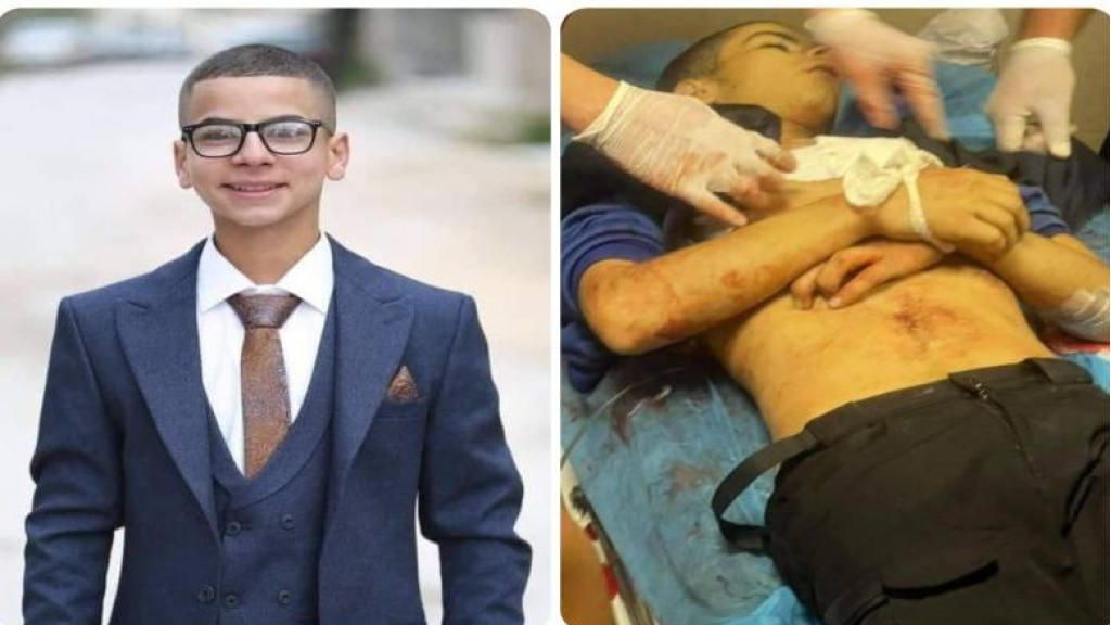 إستشهاد فتى فلسطيني برصاص الإحتلال بنابلس