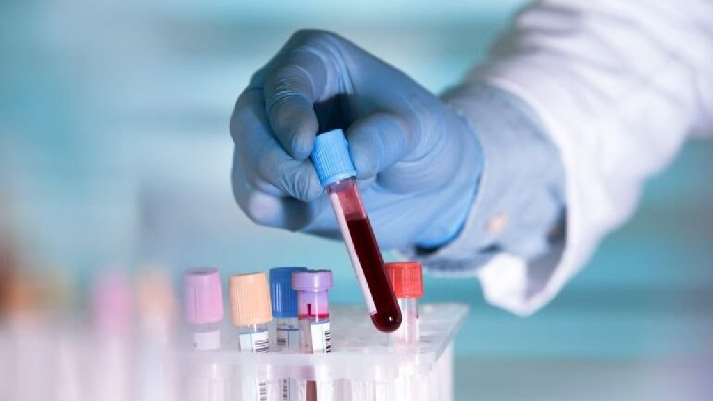 إختبار دم يكشف عن ألزهايمر دون الحاجة للتصوير الدماغي