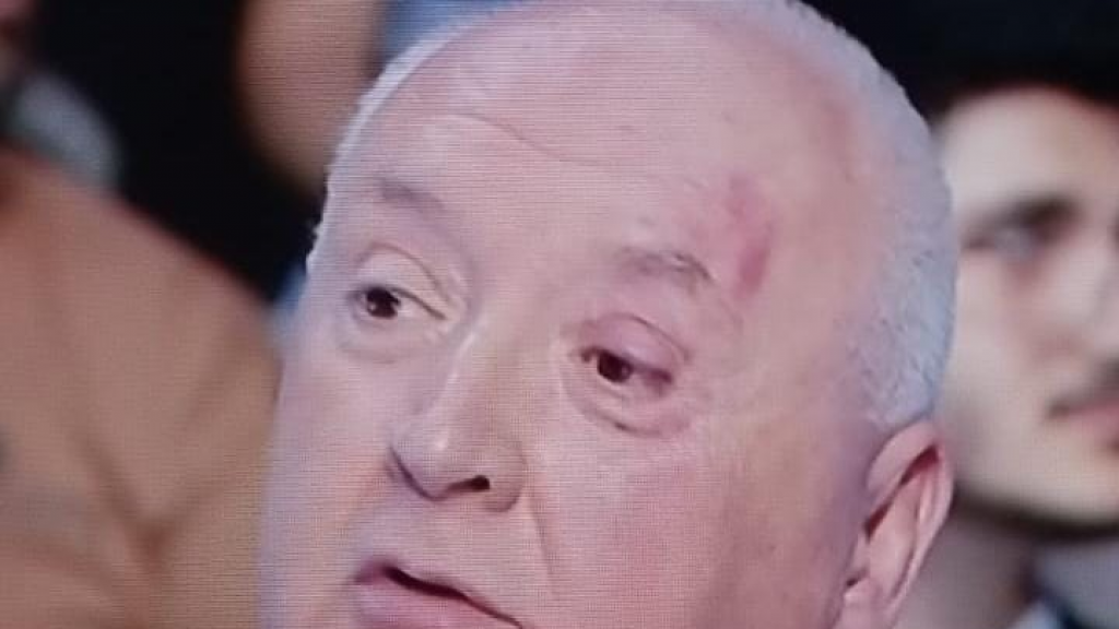 بالفيديو- الإشكال يتجدد خارج استديو 