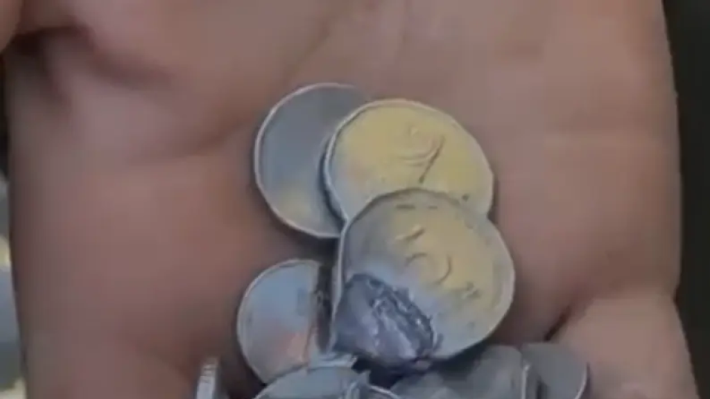 بالفيديو -  عملة معدنية تنقذ شاباً من موت محتم