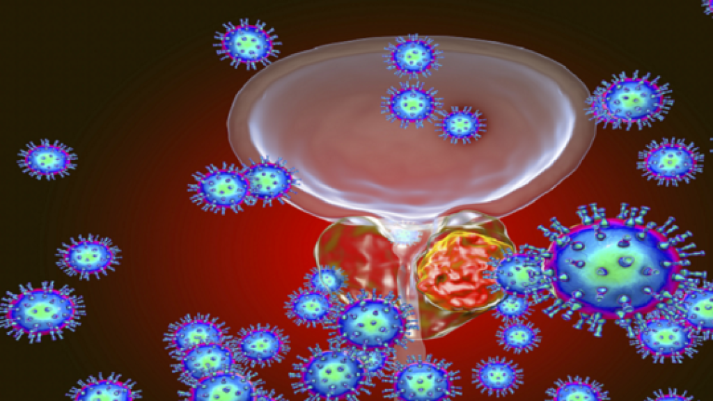 الأعراض الأولى لسرطان البروستاتا... 