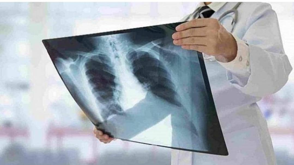 إصابة رجل بمرض في الرئة بسبب عادة شم جواربه