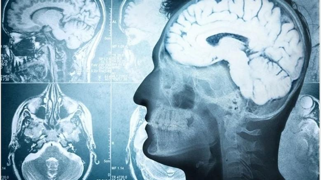 30 ثانية قبل الموت.. ماذا كشف أول تسجيل لدماغ إنسان يحتضر