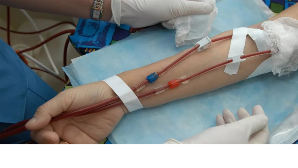 الضمان الاجتماعي يحوّل 126 مليار ليرة لتغطية علاج مرضى غسيل الكلى