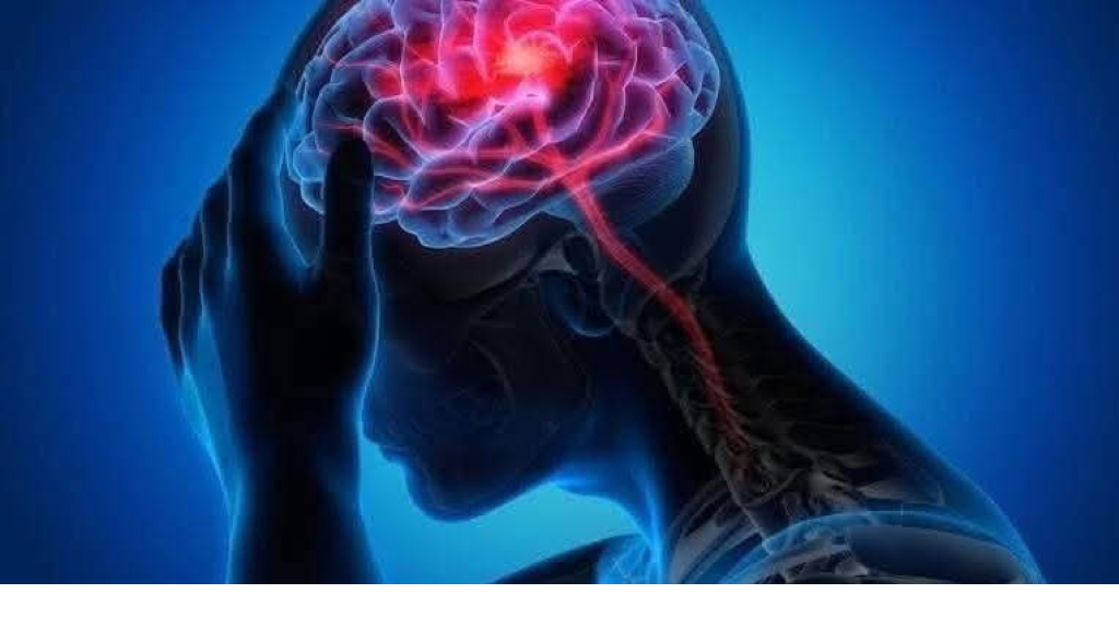 ما الذي يسبب الجلطة الدماغية؟