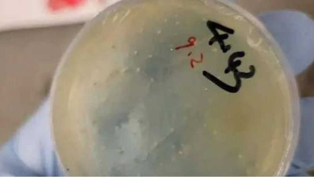 تهريب مواد بيولوجية وديدان.. اعتقال عالمة صينية في أميركا