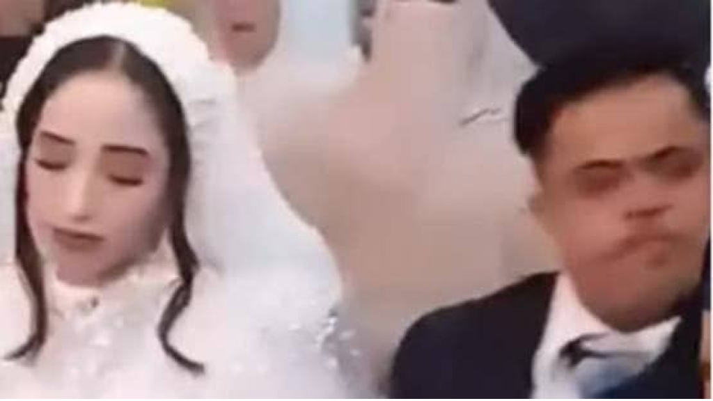 بعد فيديو زواجها من مصاب بمتلازمة داون.. تعليق من العروس