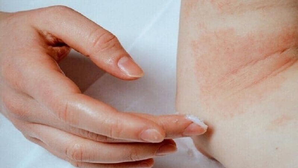 تحيط بنا طوال الوقت!.. أخطر مسببات الحساسية