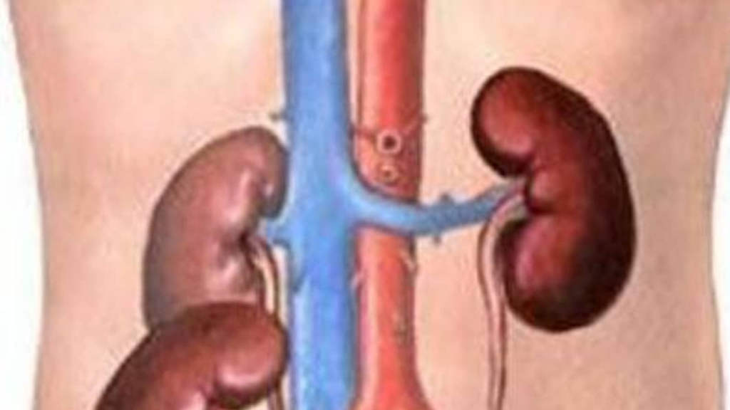 عملية زرع الكلى تحتفل بعيد ميلادها الـ75