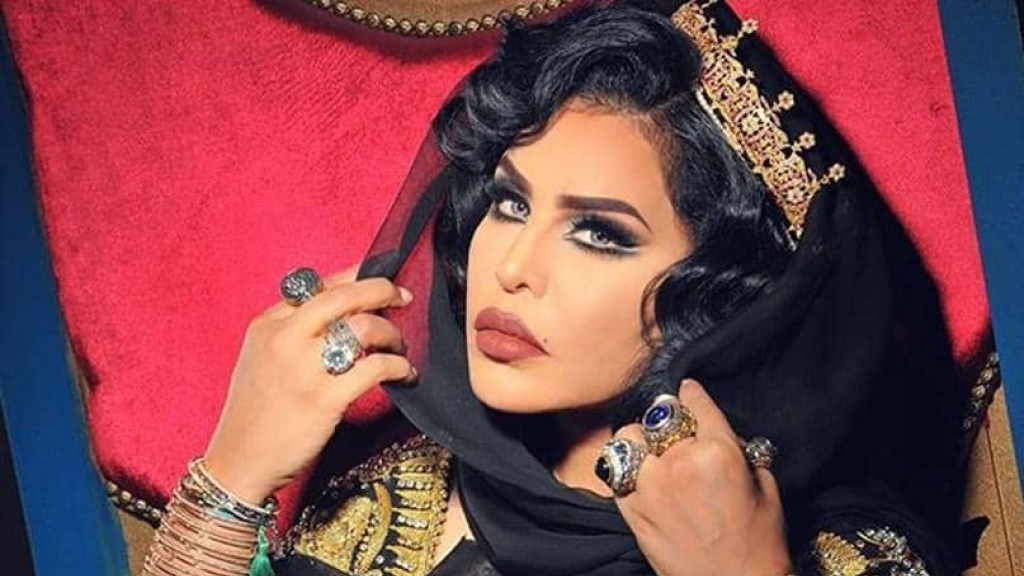 لقب الملكة سبقه حياةٌ صعبة عاشتها أحلام