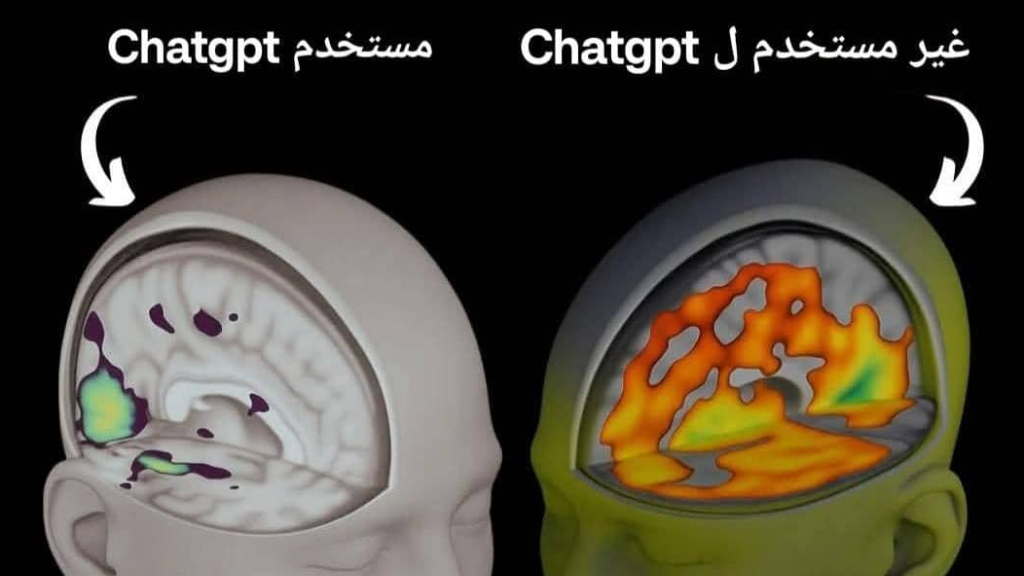 هل الذكاء الاصطناعي.. يضعف قدراتنا العقلية.. ؟