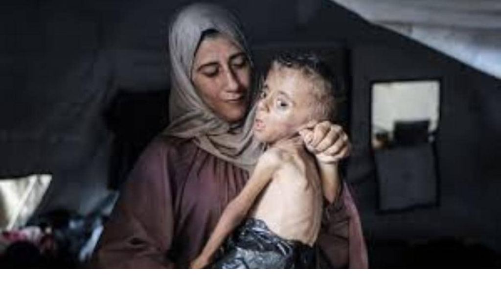 11 وفاة جوعًا في غزة خلال 24 ساعة