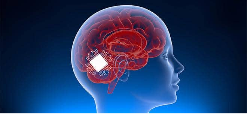 علماء يطورون أول شريحة دماغية لترجمة الأفكار إلى كلمات منطوقة