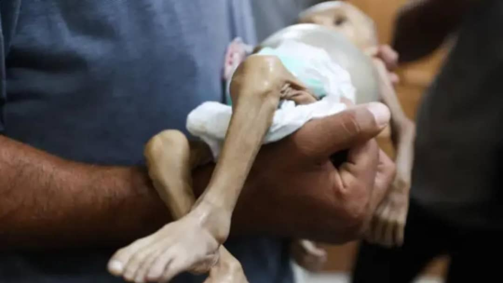 الطفلة جنى جائعة وتخشى أن تلقى مصير شقيقتها في قطاع غزة