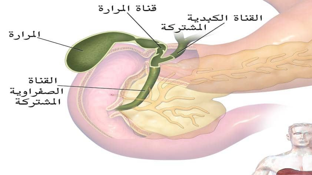 عواقب ركود الصفراء