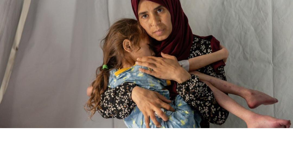 وفيتان بالمجاعة في غزة الأحد