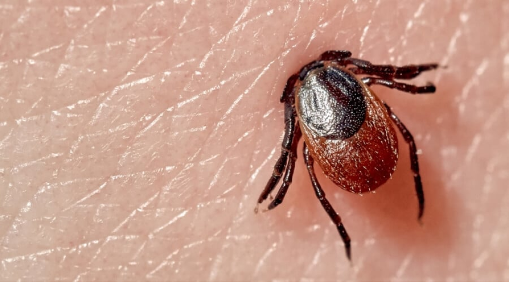 لدغات صغيرة ونتيجة صادمة... أول وفاة مرتبطة بمتلازمة 