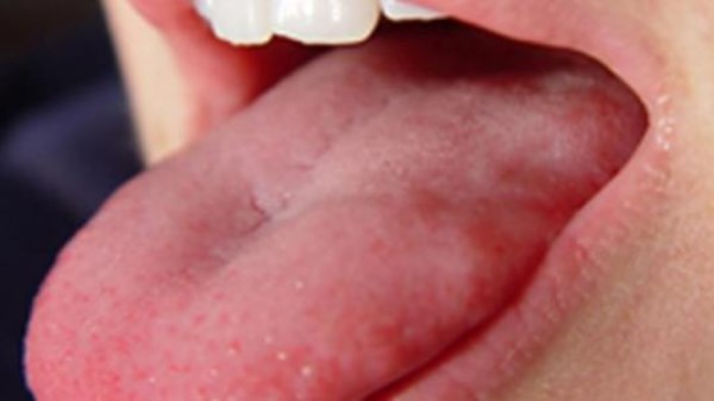 أسباب عض اللسان أثناء النوم .. 7 أسباب محتملة