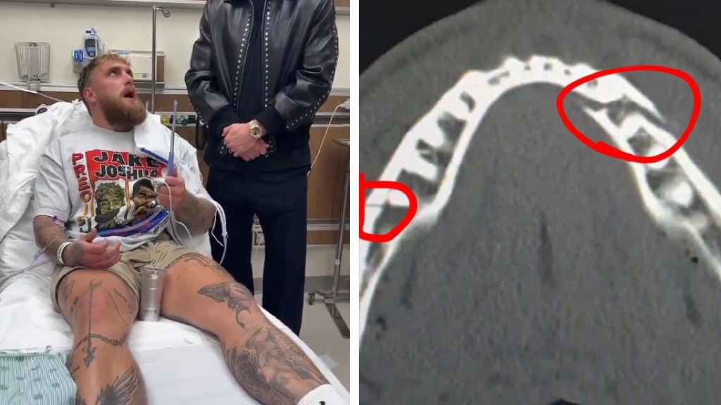 بعد كسر فكه أمام جوشوا.. جيك بول في طائرة مليئة بالأموال ( فيديو و صورة)