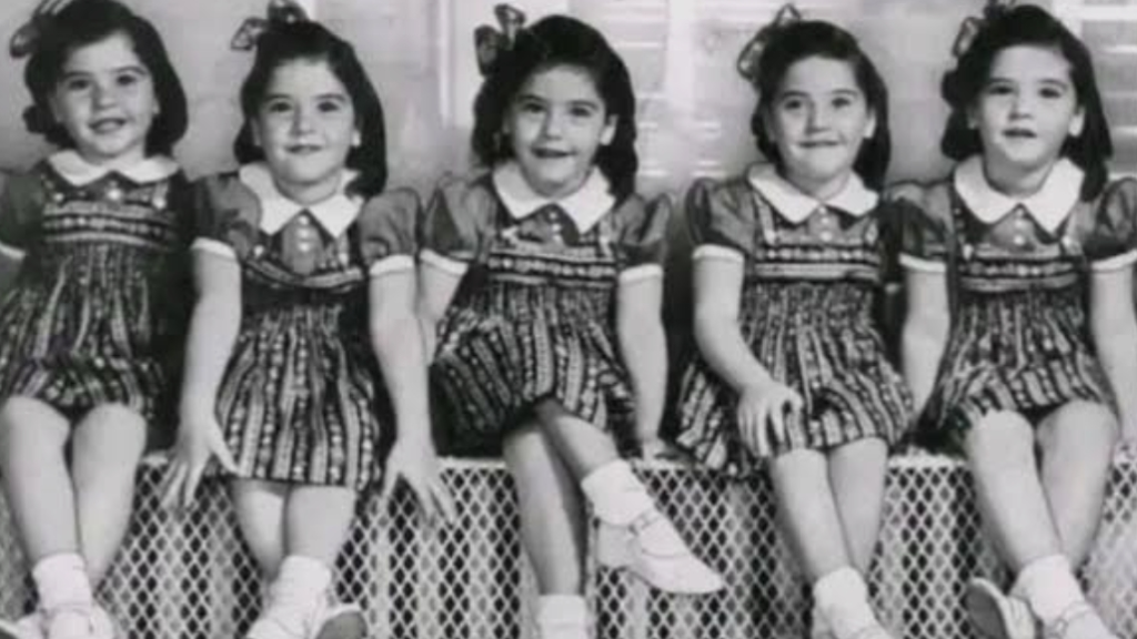 وفاة آخر توائم المعجزة الكندية التي أدهشت العالم (صور)