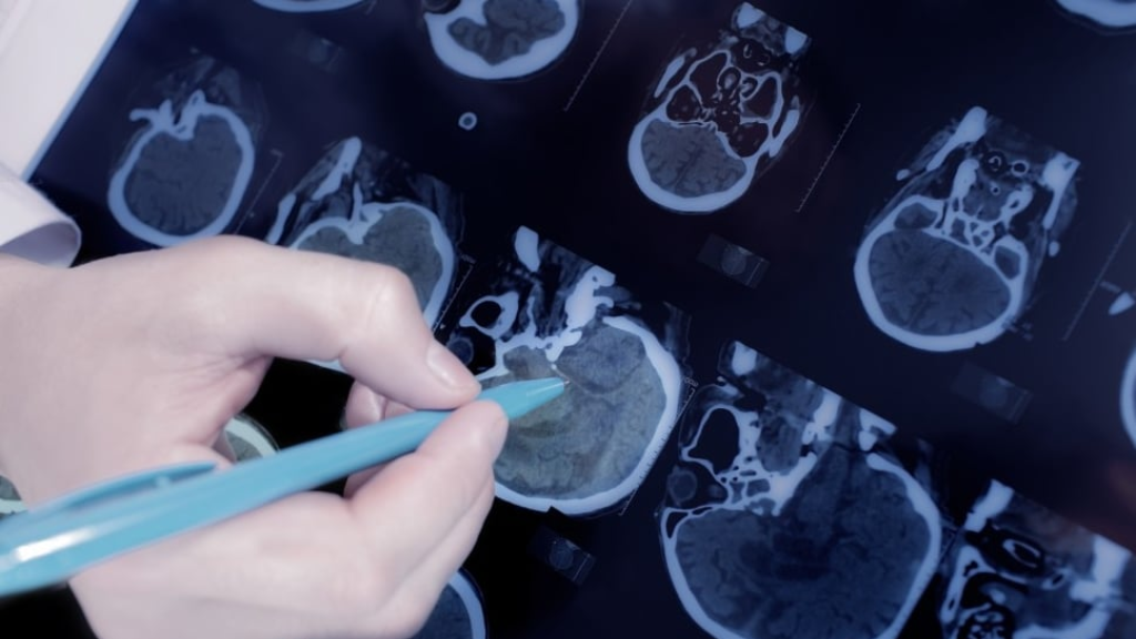 إختراق طبي روسي!