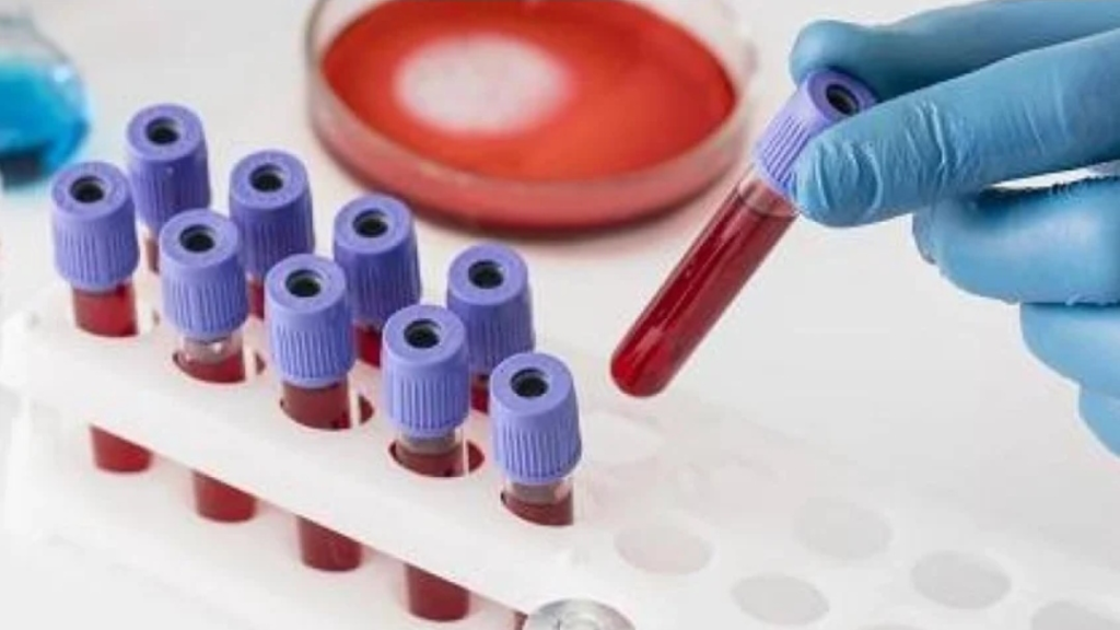 وخزة إصبع تكشف الزهايمر قبل ظهور الأعراض