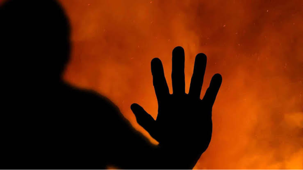 أحرق زوجته بـ”الأسيد” بسبب الطلاق! (صورة)