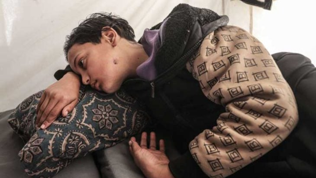 الطفل صهيب في غزة.. خرج لجلب الطعام فعاد فاقداً الكلام- (صور)