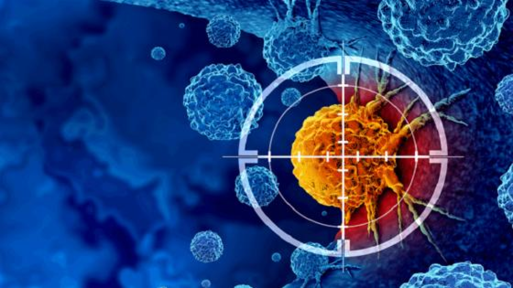 إحذروا.. هذا المرض الشائع قد يزيد خطر الإصابة بنوعين من السرطان!