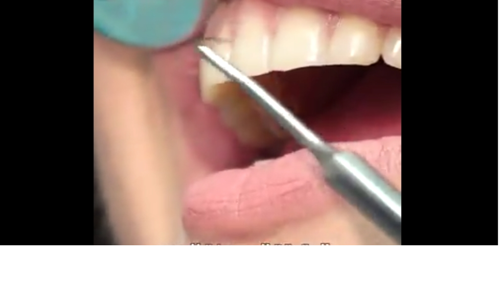 دواء جديد من اليابان قد يُعيد للإنسان القدرة على إنبات أسنانه من جديد (فيديو)