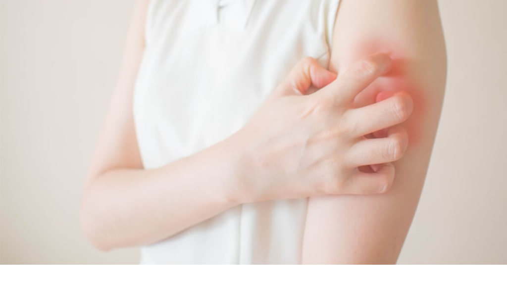 عدوى جديدة تثير المخاوف… والقلق يرافق ظهورها في لبنان: لا داعي للهلع!