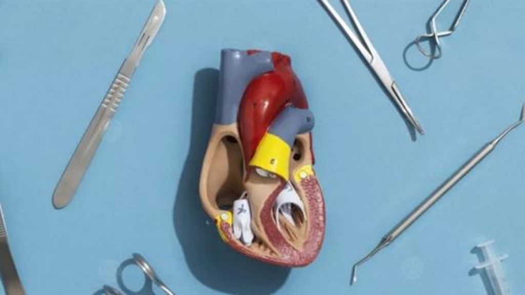من بينها جراحة القلب المفتوح.. إجراءات طبية يخشاها الأطباء قبل المرضى