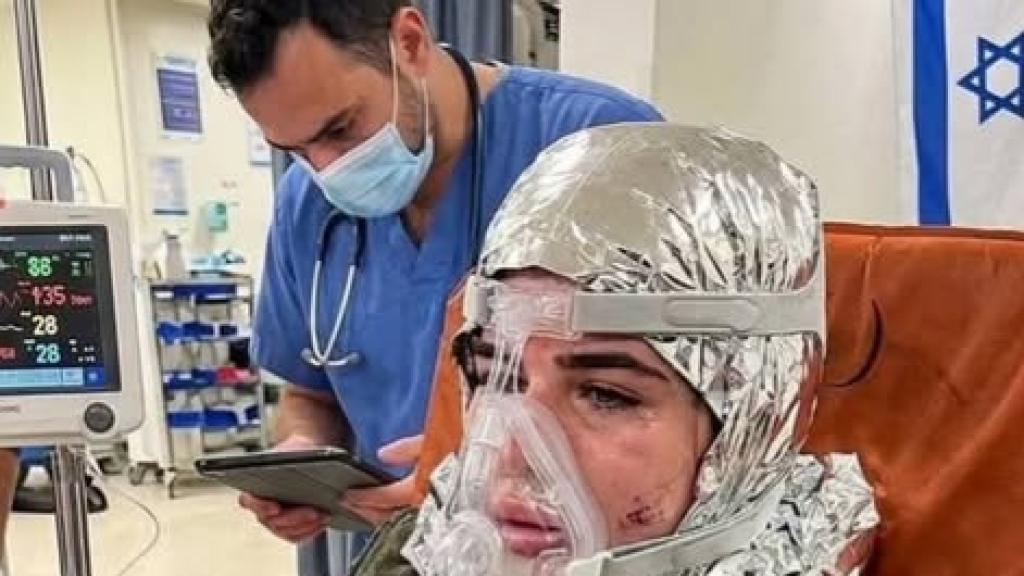 صورة متداولة لجندية في جيش الاحتلال تعرضت لإصابة جراء شظية صاروخ إيراني في حيفا بالأراضي المحتلة