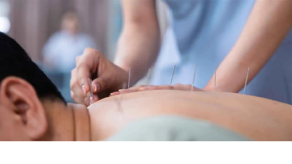 بديل للأفيونات.. الصحة العالمية تتجه لدمج الوخز بالإبر في الأنظمة الصحية
