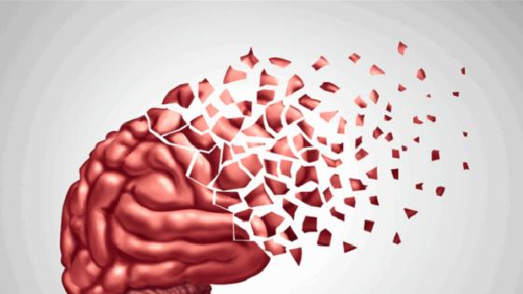هل ينتقل مرض ألزهايمر عبر عمليات نقل الدم؟ دراسة طبية تكشف