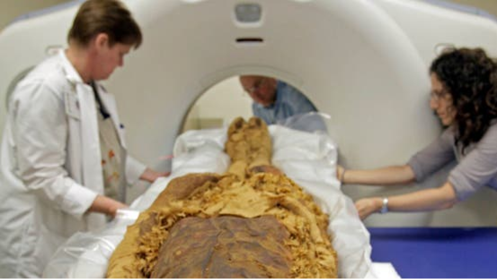 لم تكن للزينة.. عظام 