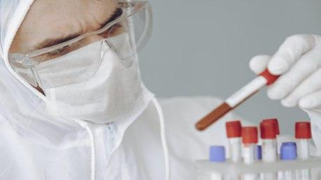 كم بلغ عدد الاصابات والوفيات بكورونا اليوم في لبنان؟